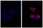 Human pancreatic carcinoma cell line MIA PaCa-2 was stained with Mouse Anti-Cytokeratin 18-UNLB (SB Cat. No. 10085-01; right) followed by Donkey Anti-Mouse IgG(H+L), Human SP ads-AF555 (SB Cat. No. 6410-32) and DAPI.