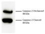 Total cell lysates from Jurkat cells were incubated with Rabbit Anti-Human DR5-UNLB (SB Cat. No. 6600-01), resolved by electrophoresis, transferred to PVDF membrane, and probed with Rat Anti-Human Caspase-2-UNLB (SB Cat. No. 17100-01).  Proteins were visualized using Goat Anti-Rat IgM-HRP (SB Cat. No. 3020-05) secondary antibody and chemiluminescent detection.