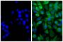 Human pancreatic carcinoma cell line MIA PaCa-2 was stained with Mouse Anti-Cytokeratin 18-UNLB (SB Cat. No. 10085-01; right) followed by Goat F(ab')<sub>2</sub> Anti-Mouse IgG(H+L), Human ads-AF488 (SB Cat. No. 1032-30) and DAPI.