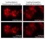 Human pancreatic carcinoma cell line MIA PaCa-2 was stained with Mouse Anti-Human CD44-UNLB (SB Cat. No. 9400-01) followed by Goat Anti-Mouse IgG, Human ads-BIOT (SB Cat. No. 1030-08) and Streptavidin-CY3 (SB Cat. No. 7100-12).