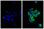 Human pancreatic carcinoma cell line MIA PaCa-2 was stained with Mouse Anti-Cytokeratin 18-UNLB (SB Cat. No. 10085-01; right) followed by Donkey Anti-Mouse IgG(H+L), Multi-Species SP ads-AF488 (SB Cat. No. 6415-30) and DAPI.