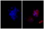 Human epithelial carcinoma cell line HEp-2 was stained with Mouse Anti-Human CD44-UNLB (SB Cat. No. 9400-01; right) followed by Goat Anti-Mouse IgG, Human ads-AF555 (SB Cat. No. 1030-32) and DAPI.