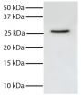 Total cell lysates from Jurkat cells were resolved by electrophoresis, transferred to PVDF membrane, and probed with Mouse Anti-Human FADD-UNLB (SB Cat. No. 10941-01).  Proteins were visualized using Goat Anti-Mouse IgG, Human ads-HRP (SB Cat. No. 1030-05) secondary antibody and chemiluminescent detection.