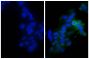 Human epithelial carcinoma cell line HEp-2 was stained with Mouse Anti-Human CD44-UNLB (SB Cat. No. 9400-01; right) followed by Goat F(ab')<sub>2</sub> Anti-Mouse Ig, Human ads-BIOT (SB Cat. No. 1012-08), Streptavidin-FITC (SB Cat. No. 7100-02), and DAPI.