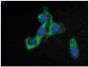 Human mammary gland carcinoma cell line HCC38 was stained with Mouse Anti-Cytokeratin 18-FITC (SB Cat. No. 10085-02) followed by DAPI.