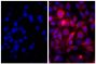 Human pancreatic carcinoma cell line MIA PaCa-2 was stained with Mouse Anti-Cytokeratin 18-UNLB (SB Cat. No. 10085-01; right) followed by Goat Anti-Mouse IgG(H+L), Human ads-AF555 (SB Cat. No. 1031-32) and DAPI.