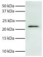 Total cell lysates from Jurkat cells were resolved by electrophoresis, transferred to PVDF membrane, and probed with Mouse Anti-Human Smac/DIABLO-UNLB (SB Cat. No. 11070-01). Proteins were visualized using Goat Anti-Mouse IgG, Human ads-HRP (SB Cat. No. 1030-05) secondary antibody and chemiluminescent detection.