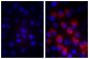 Human pancreatic carcinoma cell line MIA PaCa-2 was stained with Mouse IgG<sub>1</sub>-BIOT (SB Cat. No. 0102-08; left) and Mouse Anti-Fibrillin-1-BIOT (SB Cat. No. 1405-08; right) followed by Streptavidin-CY3.5 (SB Cat. No. 7100-24) and DAPI.