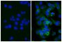 Human pancreatic carcinoma cell line MIA PaCa-2 was stained with Mouse Anti-Human CD44-UNLB (SB Cat. No. 9400-01; right) followed by Rabbit Anti-Mouse IgG(H+L), Human ads-BIOT (SB Cat. No. 6175-08), Streptavidin-FITC (SB Cat. No. 7100-02), and DAPI.