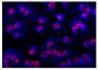 Activated human neutrophils from AAV patients were stained with anti-elastase followed by Goat Anti-Rabbit IgG(H+L), Mouse/Human ads-TRITC (SB Cat. No. 4050-03) and DAPI.<br/>Image from Yuan J, Gou S, Huang J, Hao J, Chen M, Zhao M. C5a and its receptors in human anti-neutrophil cytoplasmic antibody (ANCA)-associated vasculitis. Arthritis Res Ther. 2012;14:R140. Figure 3(f)<br/>Reproduced under the Creative Commons license https://creativecommons.org/licenses/by/2.0/