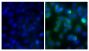 Human pancreatic carcinoma cell line MIA PaCa-2 was stained with Mouse Anti-Human CD44-BIOT (SB Cat. No. 9400-08; right) followed by Streptavidin-CY2 (SB Cat. No. 7100-21), DAPI, and mounted with Fluoromount-G<sup>®</sup> Anti-Fade (SB Cat. No. 0100-35).