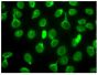 HEp-2 cells were stained with female (NZWxB6.Lbric)F1 mouse serum followed by Goat Anti-Mouse Ig, Human ads-FITC (SB Cat. No. 1010-02).<br/>Image from Singh N, Johnstone DB, Martin KA, Tempera I, Kaplan MJ, Denny MF. Alterations in nuclear structure promote lupus autoimmunity in a mouse model. Dis Model Mech. 2016;9:885-97. Figure S6<br/>Reproduced under the Creative Commons license https://creativecommons.org/licenses/by/3.0/