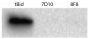 Supernatant fractions from Bax-/- mouse embryonic fibroblasts were incubated with caspase-8-cleaved human Bid (tBid) and anti-Bak (Clone 7D10 and Clone 8F8), resolved by electrophoresis, transferred to membrane, and probed with anti-cytochrome c followed by Goat Anti-Mouse Ig, Human ads-HRP (SB Cat. No. 1010-05) and chemiluminescent detection.<br/>Image from Iyer S, Anwari K, Alsop AE, Yuen WS, Huang DC, Carroll J, et al. Identification of an activation site in Bak and mitochondrial Bax triggered by antibodies. Nat Commun. 2016;7:11734. Figure 1(a)<br/>Reproduced under the Creative Commons license https://creativecommons.org/licenses/by/4.0/