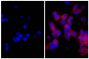 Human pancreatic carcinoma cell line MIA PaCa-2 was stained with Mouse Anti-Cytokeratin 18-UNLB (SB Cat. No. 10085-01; right) followed by Goat Anti-Mouse Kappa-TRITC (SB Cat. No. 1050-03) and DAPI.