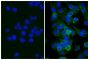 Human pancreatic carcinoma cell line MIA PaCa-2 was blocked with Normal Rabbit Serum (SB Cat. No. 0040-01) and stained with Mouse Anti-Human CD44-UNLB (SB Cat. No. 9400-01; right) followed by Rabbit Anti-Mouse IgG(H+L), Human ads-BIOT (SB Cat. No. 6175-08), Streptavidin-FITC (SB Cat. No. 7100-02), and DAPI.