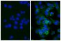 Human pancreatic carcinoma cell line MIA PaCa-2 was blocked with Normal Rabbit Serum (SB Cat. No. 0040-01) and stained with Mouse Anti-Human CD44-UNLB (SB Cat. No. 9400-01; right) followed by Rabbit Anti-Mouse IgG(H+L), Human ads-BIOT (SB Cat. No. 6175-08), Streptavidin-FITC (SB Cat. No. 7100-02), and DAPI.