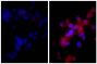 Human hepatocellular carcinoma cell line Hep G2 was stained with Rabbit IgG-UNLB isotype control (SB Cat. No. 0111-01; left) and Rabbit Anti-Human DR5-UNLB (SB Cat. No. 6600-01; right) followed by Donkey Anti-Rabbit IgG(H+L), Mouse/Rat/Human SP ads-BIOT (SB Cat. No. 6440-08, Streptavidin-CY3 (SB Cat. No. 7100-12), and DAPI.