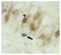 Paraffin embedded chicken nasal cavity section  infected with H7N1 highly pathogenic avian influenza virus was stained with anti-IAV NP followed by Goat Anti-Mouse Ig, Human ads-AP (SB Cat. No. 1010-04) and BCIP/NBT and then anti-PGP9.5 followed a secondary antibody and DAB.<br/>Image from Chaves AJ, Busquets N, Valle R, Rivas R, Vergara-Alert J, Dolz R, et al. Neuropathogenesis of a highly pathogenic avian influenza virus (H7N1) in experimentally infected chickens. Vet Res. 2011;42:106. Figure 5<br/>Reproduced under the Creative Commons license https://creativecommons.org/licenses/by/2.0/