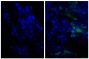 Paraffin embedded human gastric cancer tissue was stained with Rabbit IgG-UNLB isotype control (SB Cat. No. 0111-01; left) and Rabbit Anti-Human IgG(H+L), Mouse ads-UNLB (SB Cat. No. 6145-01; right) followed by Donkey Anti-Rabbit IgG(H+L), Mouse/Rat/Human SP ads-AF488 (SB Cat. No. 6440-30) and DAPI.