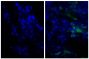 Paraffin embedded human gastric cancer tissue was stained with Rabbit IgG-UNLB isotype control (SB Cat. No. 0111-01; left) and Rabbit Anti-Human IgG(H+L), Mouse ads-UNLB (SB Cat. No. 6145-01; right) followed by Donkey Anti-Rabbit IgG(H+L), Mouse/Rat/Human SP ads-AF488 (SB Cat. No. 6440-30) and DAPI.