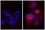 Human epithelial carcinoma cell line HEp-2 was stained with Mouse Anti-Human CD44-UNLB (SB Cat. No. 9400-01; right) followed by Goat Anti-Mouse IgG(H+L), Human ads-TRITC (SB Cat. No. 1031-03) and DAPI.