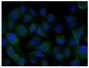 Human pancreatic carcinoma cell line MIA PaCa-2 was stained with Mouse Anti-Human EGFR-UNLB (SB Cat. No. 10400-01) followed by Goat Anti-Mouse IgG, Human ads-AF488 (SB Cat. No. 1030-30) and DAPI.