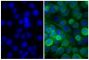 Human pancreatic carcinoma cell line MIA PaCa-2 was stained with Mouse Anti-Cytokeratin 18-UNLB (SB Cat. No. 10085-01; right) followed by Goat Anti-Mouse IgG(H+L), Rat ads-FITC (SB Cat. No. 1034-02) and DAPI.