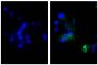 Human hepatocellular carcinoma cell line Hep G2 was stained with Rabbit IgG-UNLB isotype control (SB Cat. No. 0111-01; left) and Rabbit Anti-Human DR5-UNLB (SB Cat. No. 6600-01; right) followed by Donkey Anti-Rabbit IgG(H+L), Mouse/Rat/Human SP ads-AF488 (SB Cat. No. 6440-30) and DAPI.