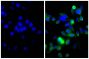 Human pancreatic carcinoma cell line MIA PaCa-2 was stained with Mouse Anti-Cytokeratin 18-UNLB (SB Cat. No. 10085-01; right) followed by Goat Anti-Mouse IgG(H+L), Multi-Species SP ads-AF488 (SB Cat. No. 1038-30) and DAPI.