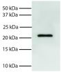 Total cell lysates from Jurkat cells were resolved by electrophoresis, transferred to PVDF membrane, and probed with Mouse Anti-Human Bid-UNLB (SB Cat. No. 10951-01). Proteins were visualized using Goat Anti-Mouse IgG, Human ads-HRP (SB Cat. No. 1030-05) secondary antibody and chemiluminescent detection.