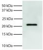 Total cell lysates from Jurkat cells were resolved by electrophoresis, transferred to PVDF membrane, and probed with Mouse Anti-Human Bid-UNLB (SB Cat. No. 10951-01).  Proteins were visualized using Goat Anti-Mouse IgG, Human ads-HRP (SB Cat. No. 1030-05) secondary antibody and chemiluminescent detection.