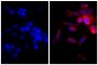 Human pancreatic carcinoma cell line MIA PaCa-2 was stained with Mouse Anti-Cytokeratin 18-UNLB (SB Cat. No. 10085-01; right) followed by Goat Anti-Mouse IgG(H+L), Multi-Species SP ads-AF555 (SB Cat. No. 1038-32) and DAPI.