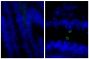 Paraffin embedded human gastric cancer tissue was stained with Rabbit Anti-Human IgG(H+L), Mouse ads-UNLB (SB Cat. No. 6145-01; right) and Rabbit IgG-UNLB (SB Cat. No. 0111-01; left) followed by Donkey F(ab')<sub>2</sub> Anti-Rabbit IgG(H+L), Mouse/Rat/Human SP ads-AF488 (SB Cat. No. 6442-30) and DAPI.