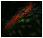 Human myofibroblasts were stained with anti-COX2 and anti-α-SMA followed by Goat Anti-Mouse IgG<sub>2a</sub>, Human ads-TXRD (SB Cat. No. 1080-07), Goat Anti-Mouse IgG<sub>1</sub>, Human ads-FITC (SB Cat. No. 1070-02), and DAPI.<br/>Image from Mattyasovszky SG, Hofmann A, Brochhausen C, Ritz U, Kuhn S, Wollstädter J, et al. The effect of the pro-inflammatory cytokine tumor necrosis factor-alpha on human joint capsule myofibroblasts. Arthritis Res Ther. 2010;12:R4. Figure 7(a)<br/>Reproduced under the Creative Commons license https://creativecommons.org/licenses/by/2.0/