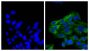 Human epithelial carcinoma cell line HEp-2 was stained with Mouse Anti-Cytokeratin 18-UNLB (SB Cat. No. 10085-01; right) followed by Goat Anti-Mouse IgG<sub>2b</sub>, Human ads-AF488 (SB Cat. No. 1090-30) and DAPI.