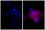 Human epithelial carcinoma cell line HEp-2 was stained with Mouse Anti-Human CD44-UNLB (SB Cat. No. 9400-01; right) followed by Goat Anti-Mouse Ig, Human ads-TRITC (SB Cat. No. 1010-03) and DAPI.