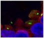 Paraffin embedded normal breast tissue section was stained with anti-acetylated tubulin (IgG<sub>2b</sub>) and γ-tubulin (IgG<sub>1</sub>) followed by Goat Anti-Mouse IgG<sub>2b</sub>, Human ads-TRITC (SB Cat. No. 1090-03), an anti-IgG<sub>1</sub> secondary antibody, and Hoechst 33342.<br/>Image from Menzl I, Lebeau L, Pandey R, Hassounah NB, Li FW, Nagle R, et al. Loss of primary cilia occurs early in breast cancer development. Cilia. 2014;3:7. Figure 1(a)<br/>Reproduced under the Creative Commons license https://creativecommons.org/licenses/by/4.0/