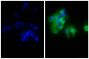 Human epithelial carcinoma cell line HEp-2 was stained with Mouse Anti-Human CD44-UNLB (SB Cat. No. 9400-01; right) followed by Goat Anti-Mouse IgG, Human ads-AF488 (SB Cat. No. 1030-30) and DAPI.