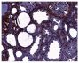 Frozen rat kidney section following SNX was stained with Goat Anti-Type IV Collagen-UNLB (SB Cat. No. 1340-01) followed by a secondary antibody and DAB.<br/>Image from Yuen DA, Connelly KA, Advani A, Liao C, Kuliszewski MA, Trogadis J, et al. Culture-modified bone marrow cells attenuate cardiac and renal injury in a chronic kidney disease rat model via a novel antifibrotic mechanism. PLoS One. 2010;5(3):e9543. Figure 3(b)<br/>Reproduced under the Creative Commons Attribution License