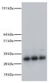 Schistosome worm antigen was resolved in triplicate by electrophoresis, transferred to PVDF membrane, and probed plasma from mice infected with S. mansoni followed by Goat Anti-Mouse IgG<sub>1</sub>, Human ads-AP (SB Cat. No. 1070-04) and chemiluminescent detection.<br/>Image from de Oliveira Fraga LA, Lamb EW, Moreno EC, Chatterjee M, Dvořák J, Delcroix M, et al. Rapid induction of IgE responses to a worm cysteine protease during murine pre-patent schistosome infection. BMC Immunol. 2010;11:56. Figure 1(f)<br/>Reproduced under the Creative Commons license https://creativecommons.org/licenses/by/2.0/