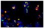 Frozen thermally burned mouse tissue section was stained with Rat Anti-Mouse CD11b-FITC (SB Cat. No. 1560-02) and Rat Anti-Mouse Ly-6G/Ly-6C-PE (SB Cat. No. 1900-09) followed by mounting with DAPI containing medium.<br/>Image from Everett J, Turner K, Cai Q, Gordon V, Whiteley M, Rumbaugh K. Arginine is a critical substrate for the pathogenesis of <i>Pseudomonas aeruginosa</i> in burn wound infections. MBio. 2017;8:e02160-16. Figure S1<br/>Reproduced under the Creative Commons license https://creativecommons.org/licenses/by/4.0/