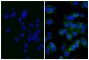 Human pancreatic carcinoma cell line MIA PaCa-2 was stained with Mouse Anti-Human CD44-UNLB (SB Cat. No. 9400-01; right) followed by Rabbit Anti-Mouse IgG(H+L), Human ads-FITC (SB Cat. No. 6175-02) and DAPI.