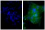 Human epithelial carcinoma cell line HEp-2 was stained with Mouse Anti-Human CD44-UNLB (SB Cat. No. 9400-01; right) followed by Goat F(ab')<sub>2</sub> Anti-Mouse Ig, Human ads-FITC (SB Cat. No. 1012-02) and DAPI.