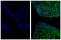 Frozen newborn mouse cartilage section was stained with Goat Anti-Type II Collagen-UNLB (SB Cat. No. 1320-01; right) followed by Donkey Anti-Goat IgG(H+L), Mouse/Rat SP ads-AF488 (SB Cat. No. 6420-30) and DAPI.