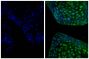 Frozen newborn mouse cartilage section was stained with Goat Anti-Type II Collagen-UNLB (SB Cat. No. 1320-01; right) followed by Donkey Anti-Goat IgG(H+L), Mouse/Rat SP ads-AF488 (SB Cat. No. 6420-30) and DAPI.