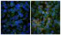 Human epithelial carcinoma cell line HEp-2 was stained with  with Mouse IgG<sub>2a</sub>-UNLB isotype control (SB Cat. No. 0103-01; left) and Mouse Anti-Human EGFR-UNLB (SB Cat. No. 10400-01; right) followed by Goat Anti-Mouse IgG(H+L), Human ads-BIOT (SB Cat. No. 1031-08), Streptavidin-CY3 (SB Cat. No. 7100-12), Rat Anti-β-Actin-FITC, and DAPI.