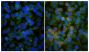 Human epithelial carcinoma cell line HEp-2 was stained with with Mouse IgG<sub>2a</sub>-UNLB isotype control (SB Cat. No. 0103-01; left) and Mouse Anti-Human EGFR-UNLB (SB Cat. No. 10400-01; right) followed by Goat Anti-Mouse IgG(H+L), Human ads-BIOT (SB Cat. No. 1031-08), Streptavidin-CY3 (SB Cat. No. 7100-12), Rat Anti-β-Actin-FITC, and DAPI.