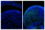 Frozen newborn mouse cartilage sections were blocked with Normal Rabbit Serum (SB Cat. No. 0040-01) and stained with Mouse Anti-Collagen Type II-UNLB (right) followed by Rabbit F(ab')<sub>2</sub> Anti-Mouse IgG(H+L), Human ads-BIOT (SB Cat. No. 6125-08), Streptavidin-CY2 (SB Cat. No. 7100-21), DAPI, and mounted with Fluoromount-G<sup>®</sup> Anti-Fade (SB Cat. No. 0100-35).