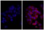 Human pancreatic carcinoma cell line MIA PaCa-2 was stained with Mouse Anti-Human CD44-UNLB (SB Cat. No. 9400-01; right) followed by Donkey Anti-Mouse IgG(H+L), Human SP ads-BIOT (SB Cat. No. 6410-08), Streptavidin-TRITC (SB Cat. No. 7100-03), and DAPI.