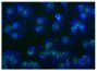 Activated human neutrophils of AAV patients were stained with anti-CD88 followed by Goat Anti-Mouse IgG(H+L), Human ads-FITC (SB Cat. No. 1031-02) and DAPI.<br/>Image from Yuan J, Gou S, Huang J, Hao J, Chen M, Zhao M. C5a and its receptors in human anti-neutrophil cytoplasmic antibody (ANCA)-associated vasculitis. Arthritis Res Ther. 2012;14:R140. Figure 3(f)<br/>Reproduced under the Creative Commons license https://creativecommons.org/licenses/by/2.0/